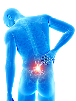 Effective Ways to Ease Sciatic Pain - Central Orthopedic Group