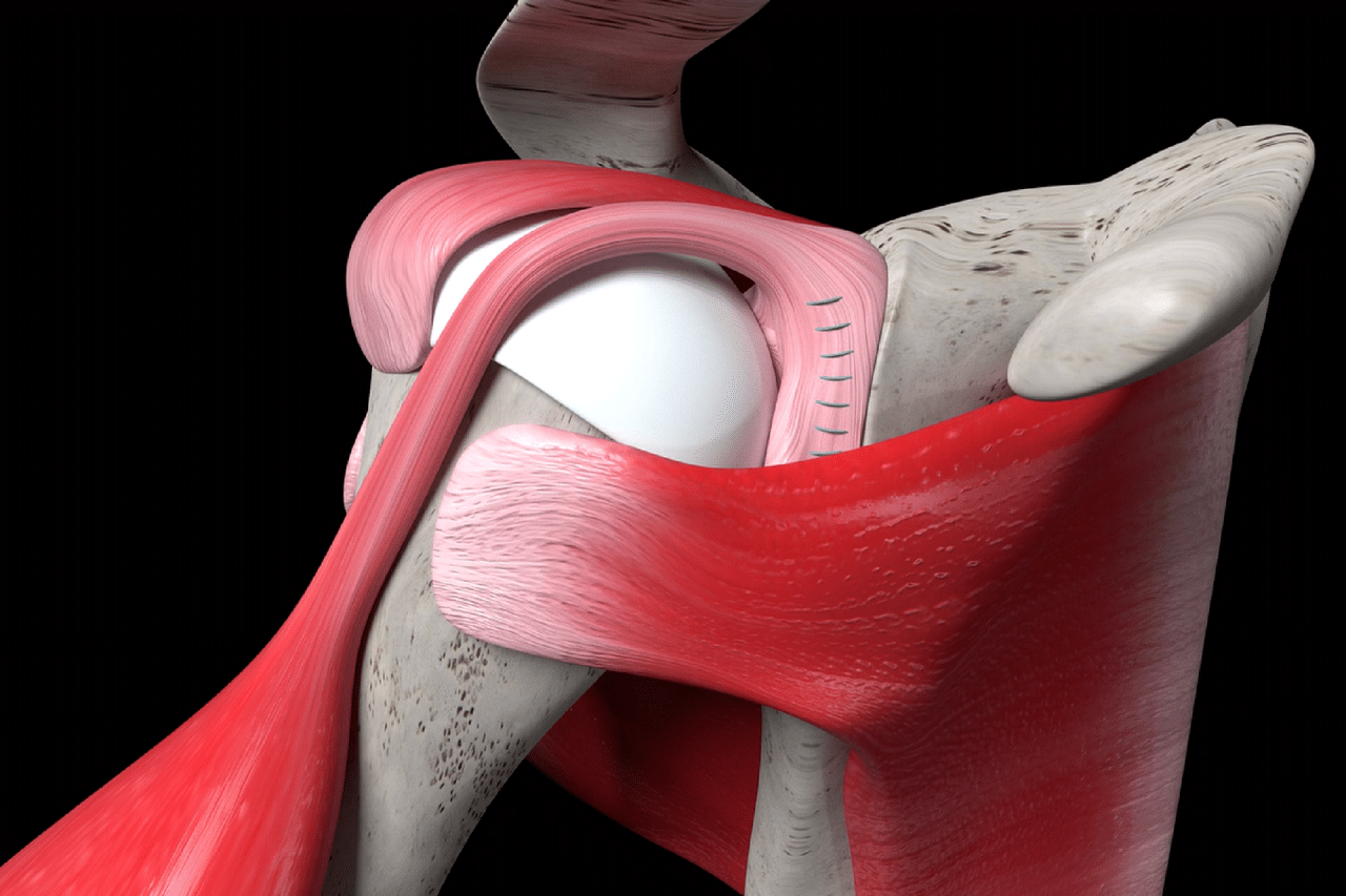 Returning to Sports and Activities After a Labral Tear | Spine ...